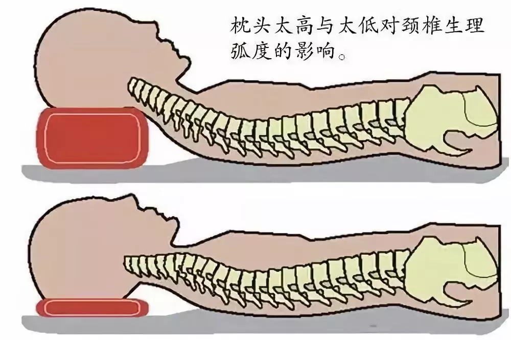 枕头应该高点好还是低点好?选错了太可怕,为了家人必须看